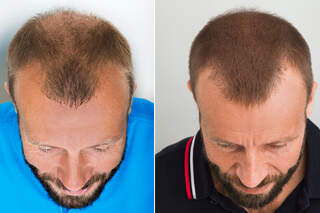 Die Richtige Haarpflege Fur Manner Men S Health