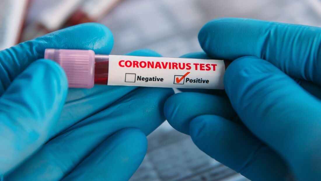 Auch vollständig gegen Corona-Viren Geimpfte können positiv auf Covid-19 getestet werden