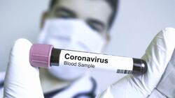 Das Coronavirus kann gefährliche Lungenentzündungen auslösen
