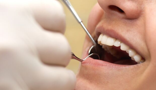 Der Zahnartz ist auch Ansprechpartner für weiße Zähne