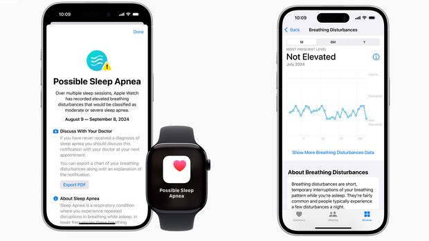Die Apple Watch kann jetzt nächtliche Atemaussetzer erfassen 