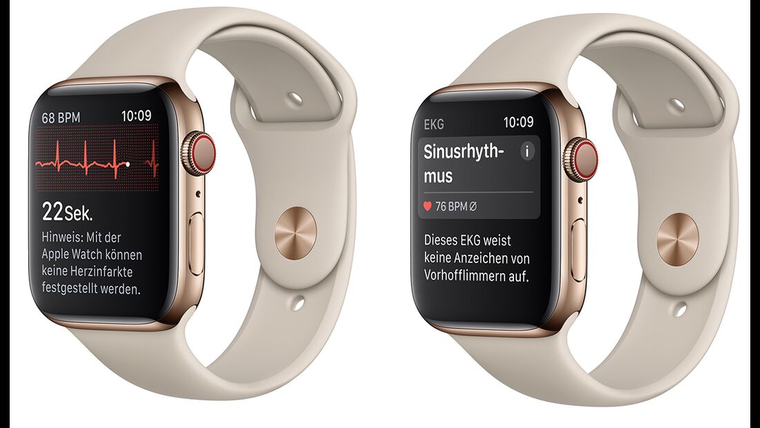 Die Apple Watch nutzt die EKG-Funktion, um nach Herzrhythmusstörungen zu suchen