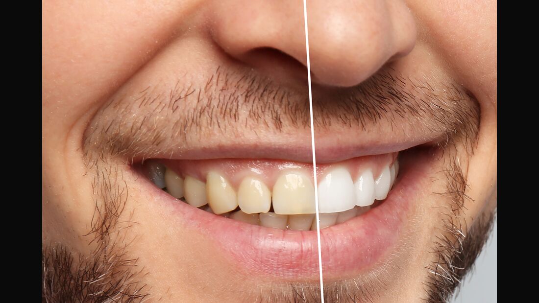 Zähne aufhellen zu Hause Damit klappt's MEN'S HEALTH