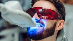 Die besten Tipps für weiße Zähne
