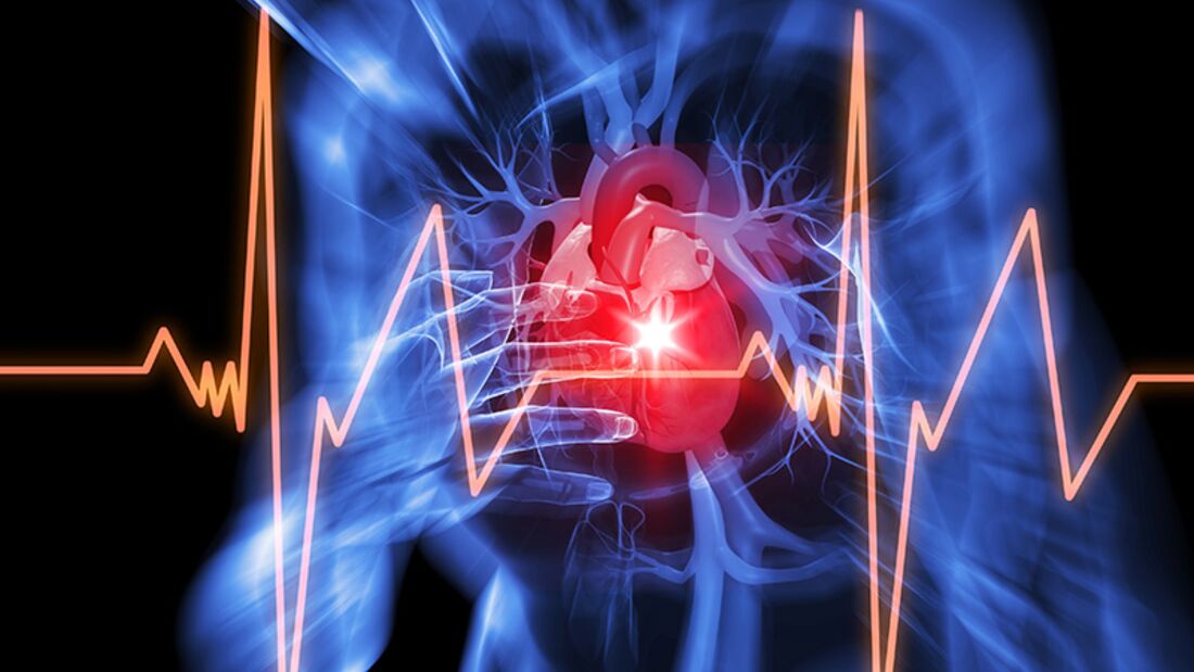 Herzinfarkt: 4 lebensrettende Ratschläge