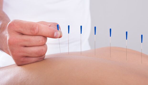Schmerzfrei durch Akupunktur