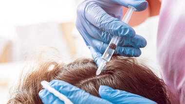 So hilft Blut gegen Haarausfall