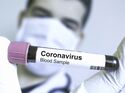 So schützt du dich wirklich vor dem Coronavirus