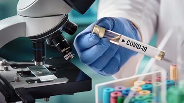 Weltweit sind Forscher auf der Suche nach einem Medikament gegen das neuartige Coronavirus